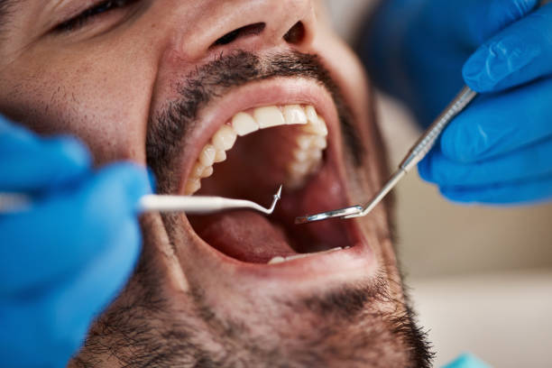 Best Emergency Tooth Extraction  in East Bakersfield, CA